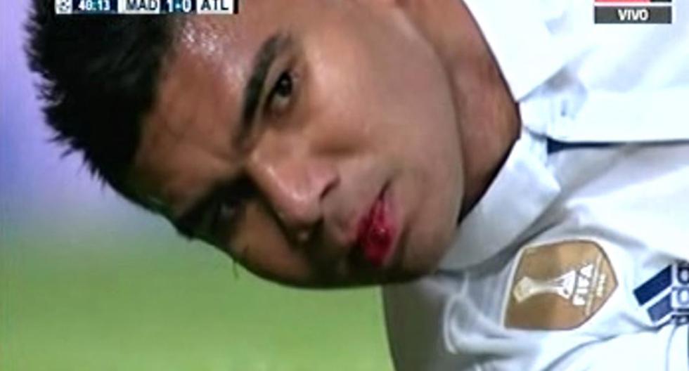Casemiro terminó sangrando tras una dura jugada en el Real Madrid vs Atlético Madrid. (Foto: captura)