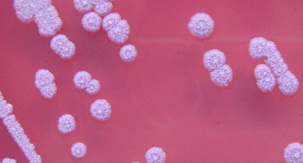 No se sabe el alcance de la bacteria, considerada peligrosa. (Foto: Wikipedia)