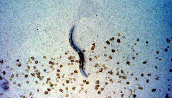 This 01 May, 2003, photo released by NASA on their website shows C. elegans nemotodes (round worms) undergoing examination by project scientists. These specimens were found in a Biological Research in Canisters container, a middeck experiment that was among the Columbia debris recovered in East Texas. The worms are descendants of those that were part of an experiment that flew on Columbia's last mission, STS-107. Scientists are now looking over the experiment at KSC to determine if it will yield any scientific results. The investigation into the cause of the Columbia accident 01 February is ongoing. AFP PHOTO/Volker KERN-NASA AMES RESEARCH CENTER (Photo by VOLKER KERN / NASA AMES RESEARCH CENTER / AFP)