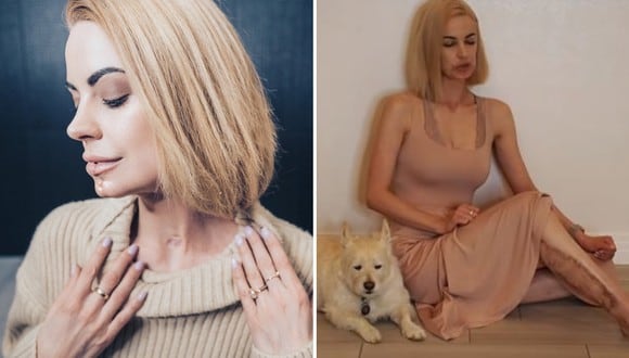 Una cantante y actriz deslumbró al Internet con su canto tras superar una terrible enfermedad bucal. (Foto: Real Elly Brown en YouTube/Instagram)