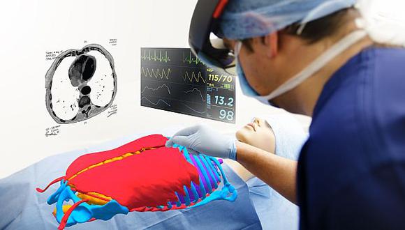 La nueva tecnolog&iacute;a de realidad aumentada le permite al cirujano ver un mapa virtual en 3D de los &oacute;rganos del paciente. (Foto: Cambridge Consultants)