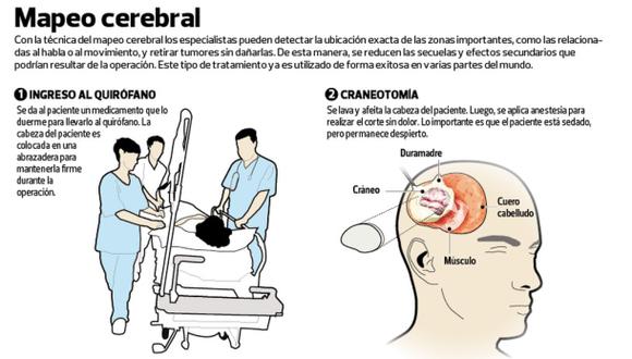 En el Perú extirpan un tumor cerebral a paciente despierto