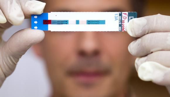 Presunto 'reto viral' entre jóvenes propagaría contagio de VIH/Sida