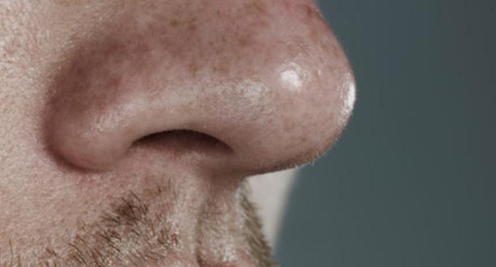 Investigadores españoles han desarrollado un prototipo de nariz electrónica capaz de distinguir entre pacientes con enfermedad de Crohn y colitis ulcerosa. (Foto: Getty Images / Referencial)