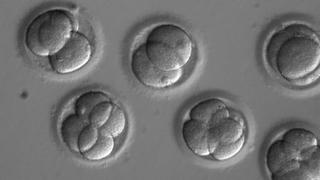 Batalla de patentes por la tecnología genética usada paracorregir embriones humanos