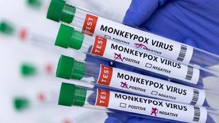Viruela del mono: Se confirma el nivel de la transmisión comunitaria de la enfermedad