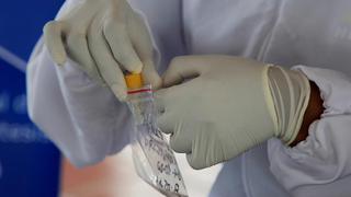 Colombia reporta 188 muertes y 8.717 nuevos contagios de coronavirus en un día