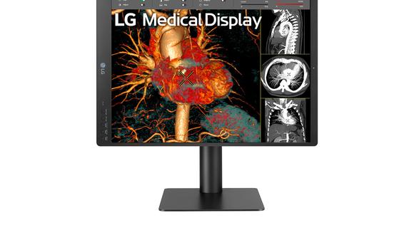 LG Medical Display es el software potenciado con inteligencia artificial para analizar radiografías de la firma tecnológica. (Foto: LG Electronics)