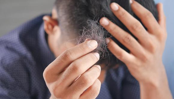 Remedios caseros evitar la caída del cabello | trucos | hacks | nnda nnni | RESPUESTAS | MAG.