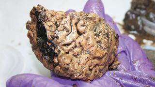 Encuentran un cerebro humano con 2 mil 600 años de antigüedad
