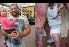Padres se tatúan la marca de nacimiento de su hija, para apoyarla