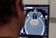 Cáncer cerebral: nuevo láser mejora eficacia de los tratamientos