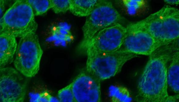 Esta investigaci&oacute;n tambi&eacute;n provee un nuevo enfoque sobre los cambios moleculares asociados con la resistencia de las c&eacute;lulas cancer&iacute;genas a los medicamentos, agreg&oacute; el comunicado. (Foto: Reuters)