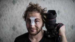 “No creía que la policía pudiera ser violenta”: fotógrafo herido en manifestación revive en París momentos de la guerra siria