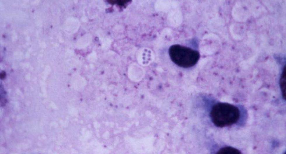 Imagen de un organismo infectado con ántrax. (Foto: kat m research/Flickr)