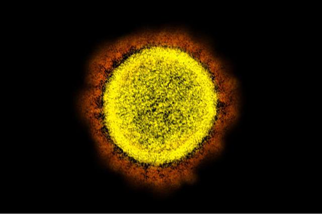 El coronavirus toma su nombre del aspecto que tiene el virus, con forma de corona. (Foto: National Institute of Allergy and Infectious Diseases [NIAID])