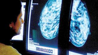 Estudio cuestiona la exactitud de biopsias en cáncer de mama