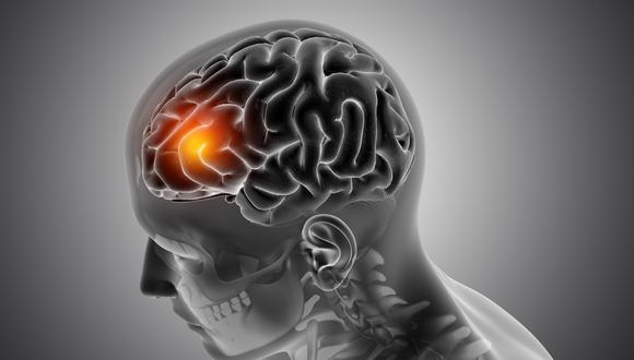 El cerebro es un órgano principal y fundamental para el control de las funciones del paciente.