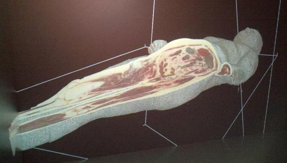 Hologramas 3D de anatomía humana como herramienta de aprendizaje para  alumnos de Medicina