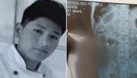 Rosalino Flores recibió más de 30 perdigones metálicos por la espalda. (Foto: Difusión/IDL)