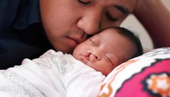En Perú, cada tres minutos nace un bebé con el labio fisurado y/o paladar hendido. (Getty Images)