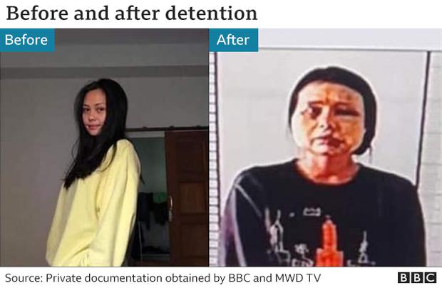 Before and after photo of Soe May, a detainee showing her battered face.