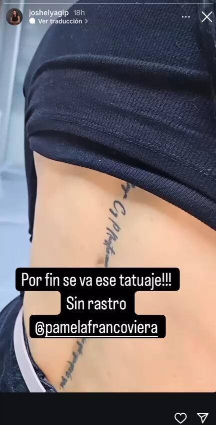 Pamela Franco se borra tatuaje de Christian Domínguez | Foto: Instagram