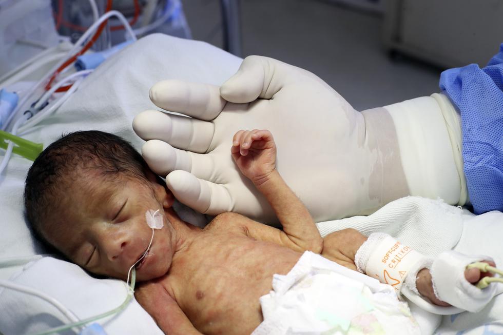 La Vida En 800 Gramos La Dura Batalla De Los Bebes Prematuros En El Peru Fotos Somos El Comercio Peru