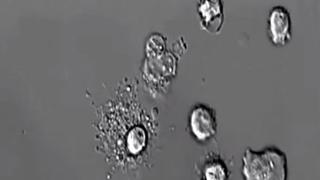 Así muere una célula humana [VIDEO]