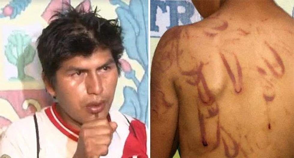 Carlos Zevallos está con mandato de comparecencia restringida por agredir a su hijo. (Foto: RPP)