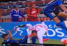 Fútbol chileno: jugador de Universidad de Chile sufre brutal lesión