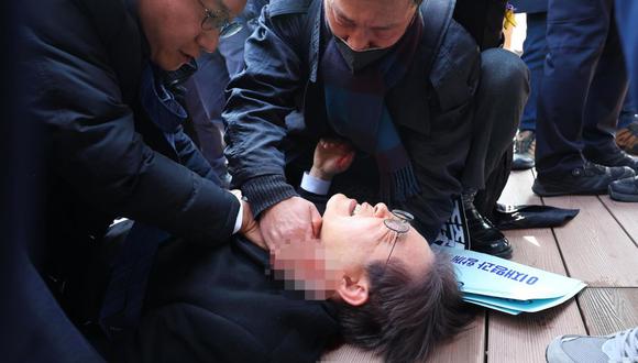 Lee fue trasladado en estado consciente al hospital unos 20 minutos después con una importante hemorragia. Foto: YONHAP SOUTH KOREA OUT
IMAGE PIXELLATED AT SOURCE / EFE/EPA
