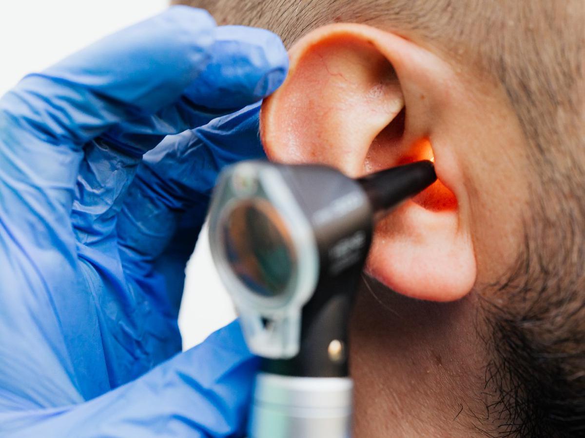 Limpieza de oídos: ¿usar o no usar hisopo? - FM Mundo
