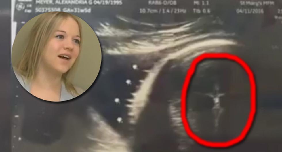 Este video de YouTube ha impactado a todas las redes sociales puesto que un crucifijo divino apareció dentro del vientre de una mujer embarazada mientras esta realizaba una ecografía. (Foto: captura)