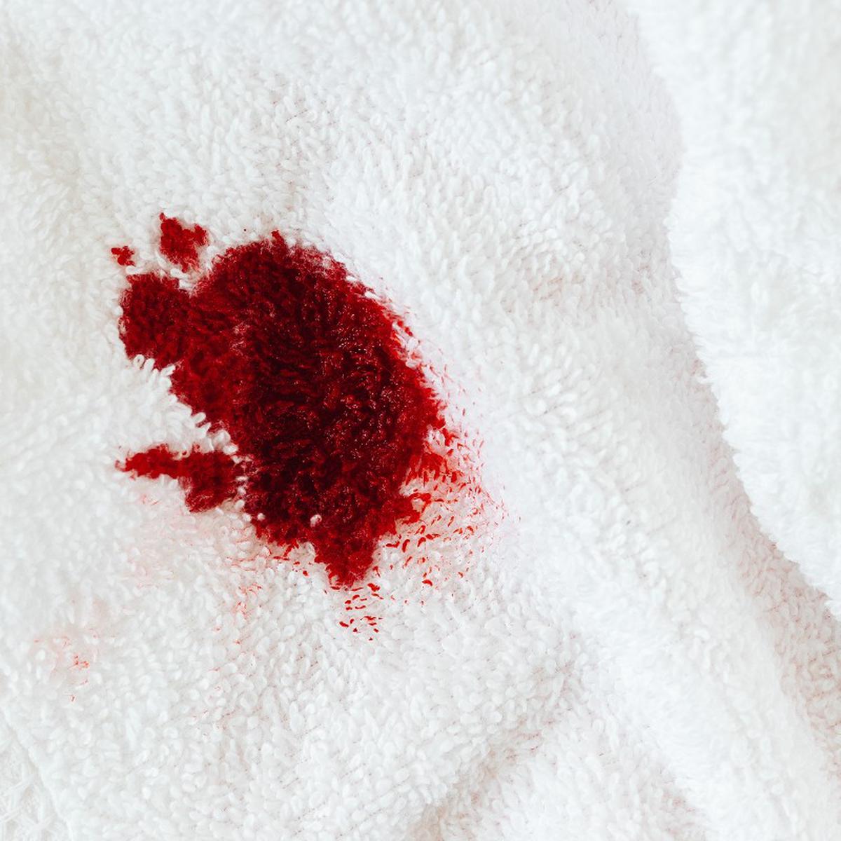 Trucos caseros para eliminar manchas de sangre recientes de la Remedios | Hacks nnda nnni | RESPUESTAS | MAG.