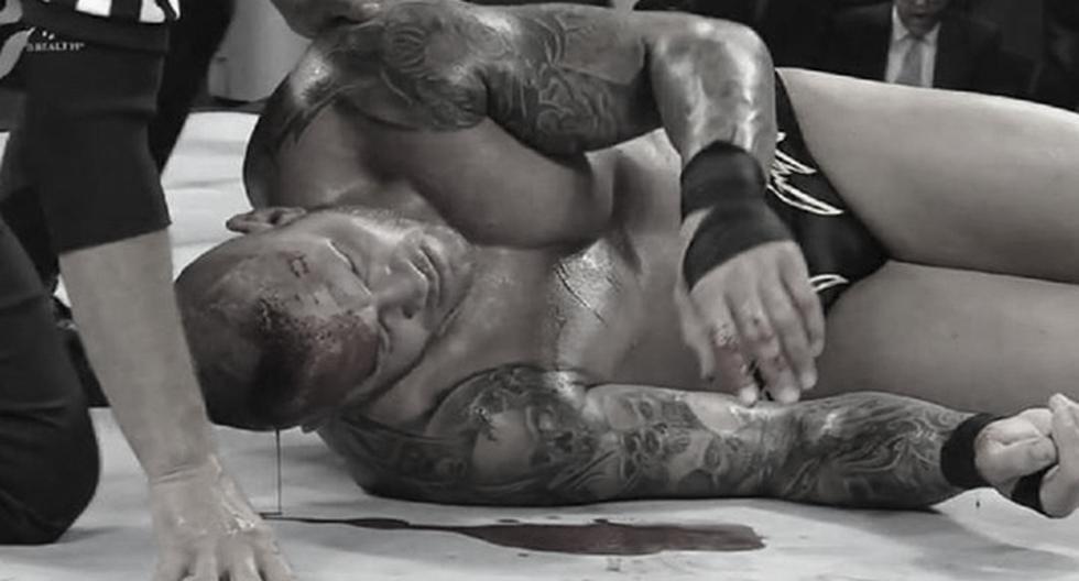 Randy Orton salió de la peor forma de SummerSlam. (Foto: Captura)