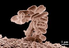 Bacteria E.coli puede causar infecciones urinarias, según estudio