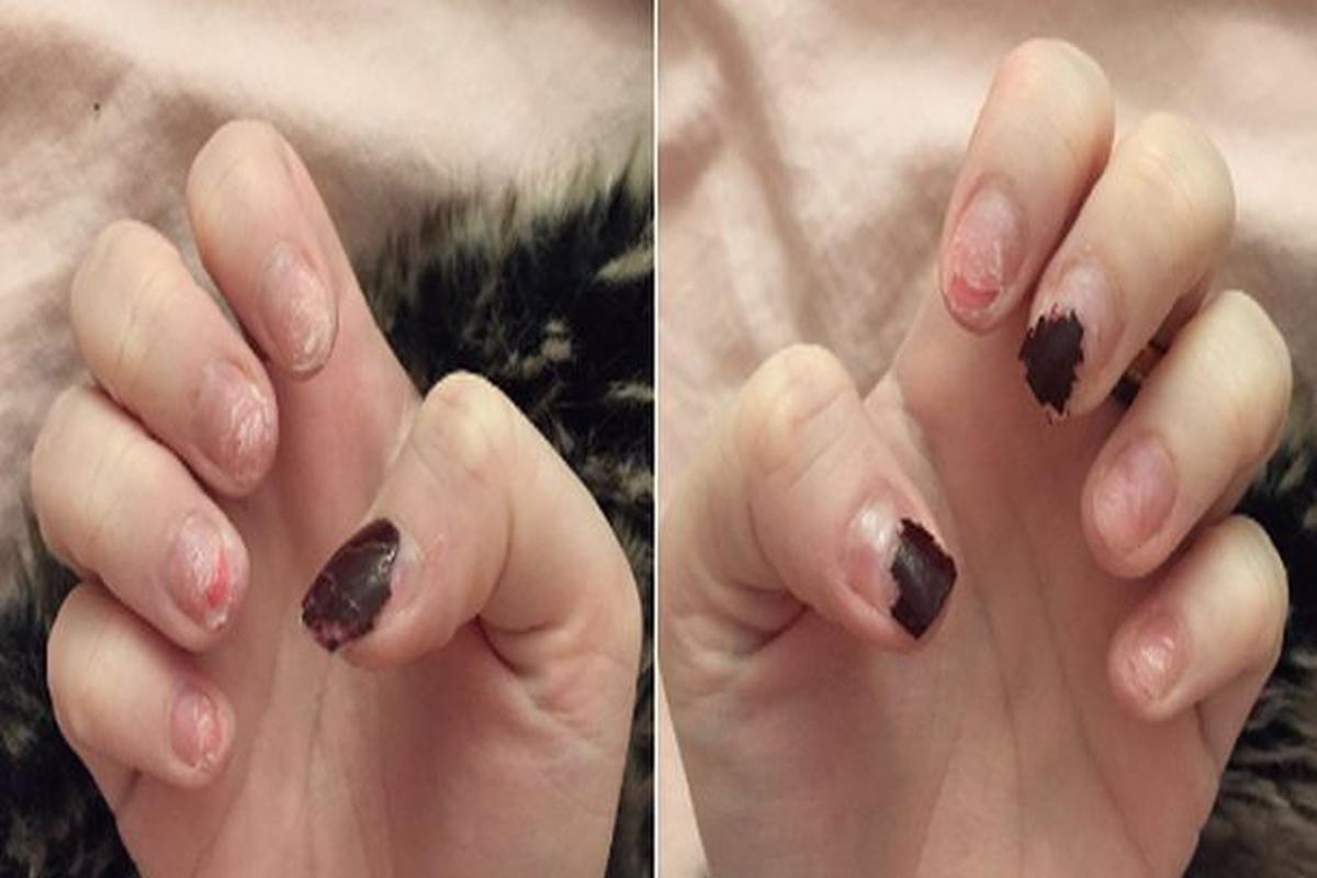 Bloguera muestra las consecuencias de usar uñas acrílicas | MUJERES |  