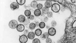 Hantavirus, el último brote que causó alerta en Argentina y Chile, y que es mucho más letal que el COVID-19