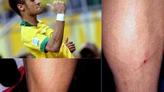 Neymar se quejó del juego sucio de Honduras: “Conseguí salir vivo”
