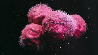 Cáncer: hallan un anticuerpo que frena propagación de tumores y previene la metástasis