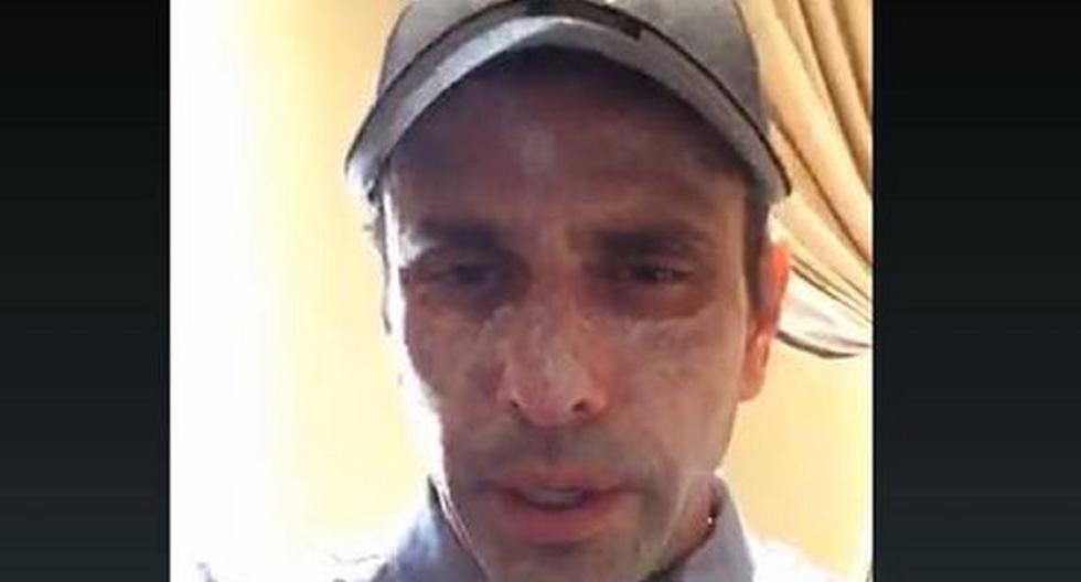 Henrique Capriles fue sometido en Estados Unidos a un tratamiento por causa de unas lesiones de piel en el rostro. (Foto: Periscope)