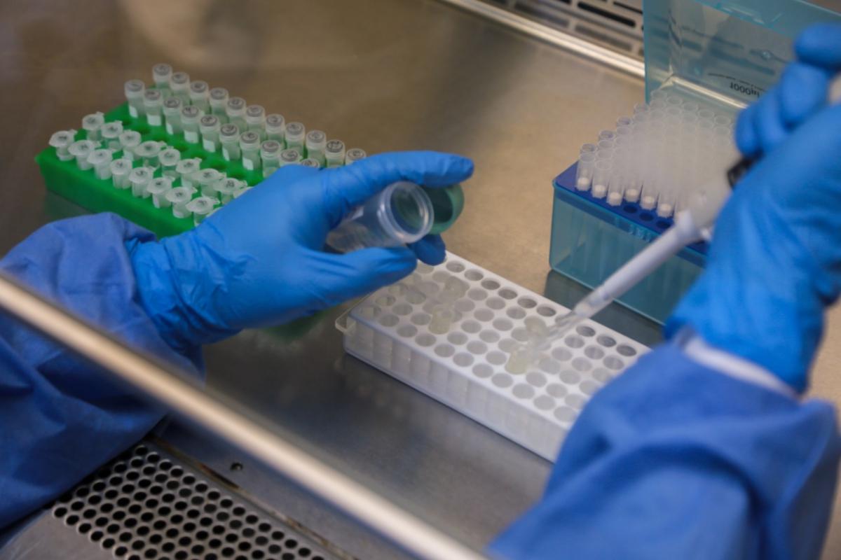 48 horas como máximo es el tiempo que puede demorar el resultado para COVID-19 de una prueba molecular  (Foto referencial: MINSA)