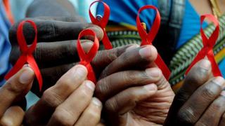 ONU: "Latinoamérica debe redoblar sus esfuerzos contra el sida"