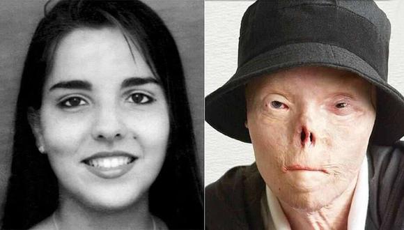 Un accidente en 1999 desfiguró totalmente a Jacqui Saburido, una venezolana que entonces tenía 20 años, pero también la convirtió en un testimonio vivo de las consecuencias de conducir ebrio