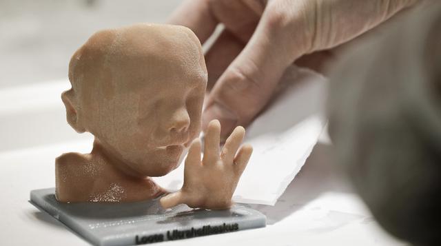 Impresión 3D: la nueva forma de tocar a tu bebé antes que nazca - 5