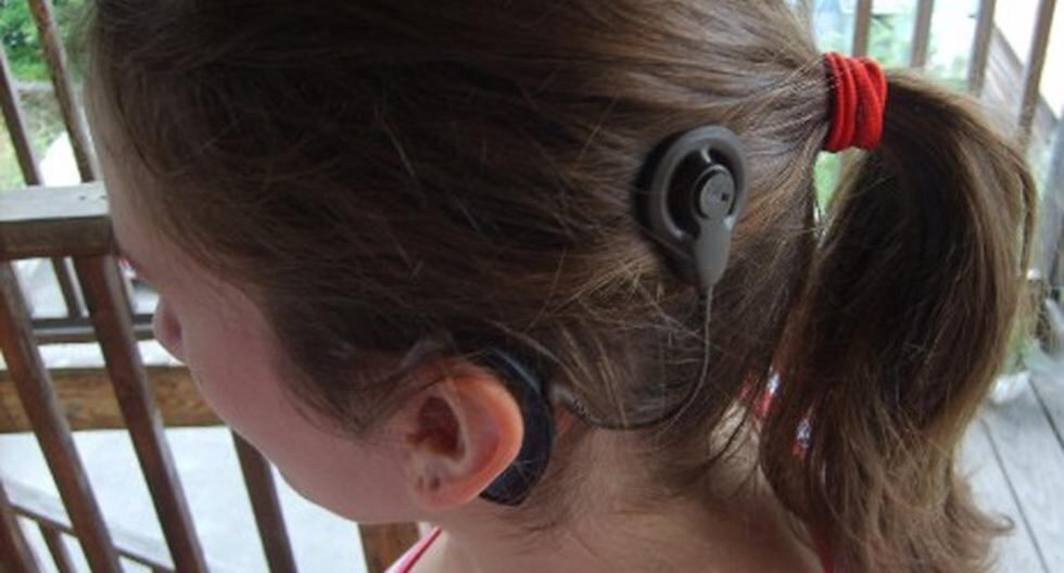 El implante coclear consiste en la implantación de un dispositivo electrónico en la oreja que estimula el nervio auditivo y envían el sonido al cerebro. (Foto: Getty Images)