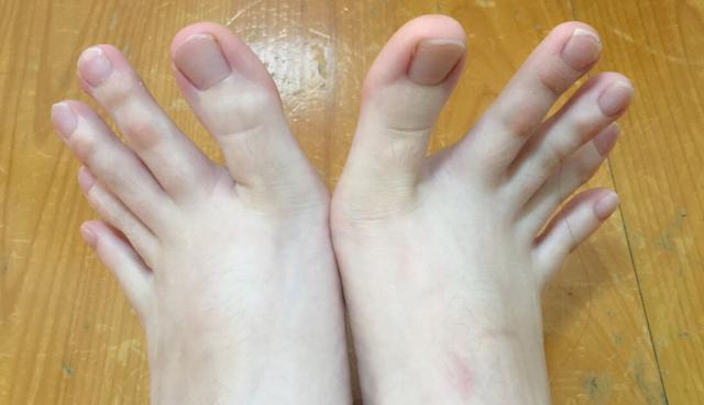 Una mujer de Taiwán sorprendió a todos en Facebook al mostrar las fotos de sus extraños pies. (Fotos: DCard en Facebook)