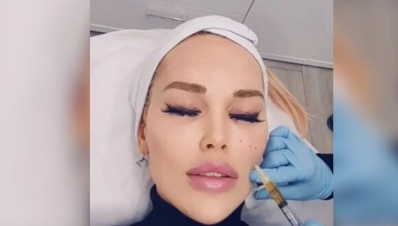 Hasta le momento, la modelo Tessa Texas ha gastado más de 50 mil euros para parecerse a los filtros de Snapchat (Foto: Instagram de tessatexas.official)
