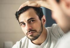 Caída del cabello: cinco consejos para prevenir la calvicie